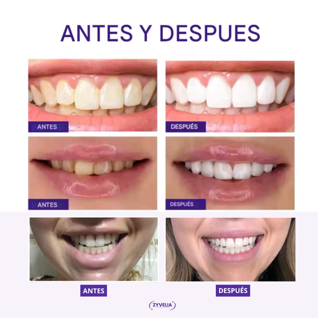 VioLuxe™ – Sonrisa más Blanca, Confianza más Fuerte. 1+1 GRATIS