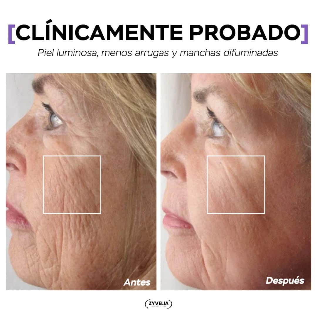 El Ritual Facial que Rejuvenece Tu Piel - Kit Premium LumiLift™