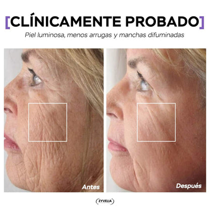 El Ritual Facial que Rejuvenece Tu Piel - Kit Premium LumiLift™